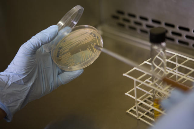 Imagem de Filme probiótico com base de celulose bacteriana nanofibrilada